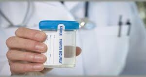 10-Panel Urine Drug Test