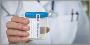 10-Panel Urine Drug Test